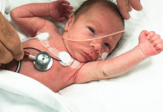 Three levels of NICU